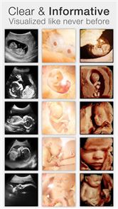 Pregnancy + image
